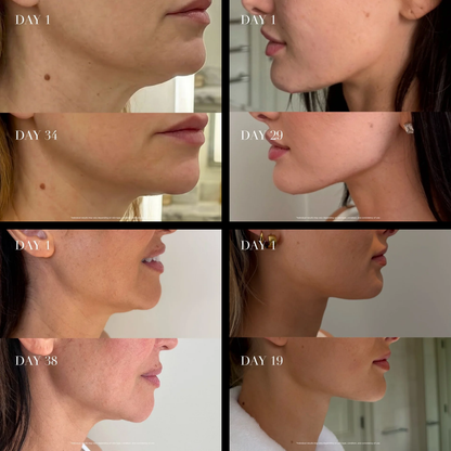 5-in-1 Facial Sculpting Wand