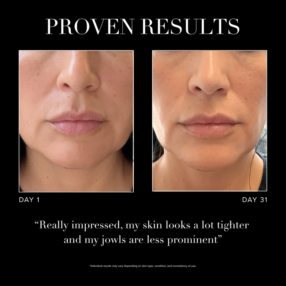 5-in-1 Facial Sculpting Wand